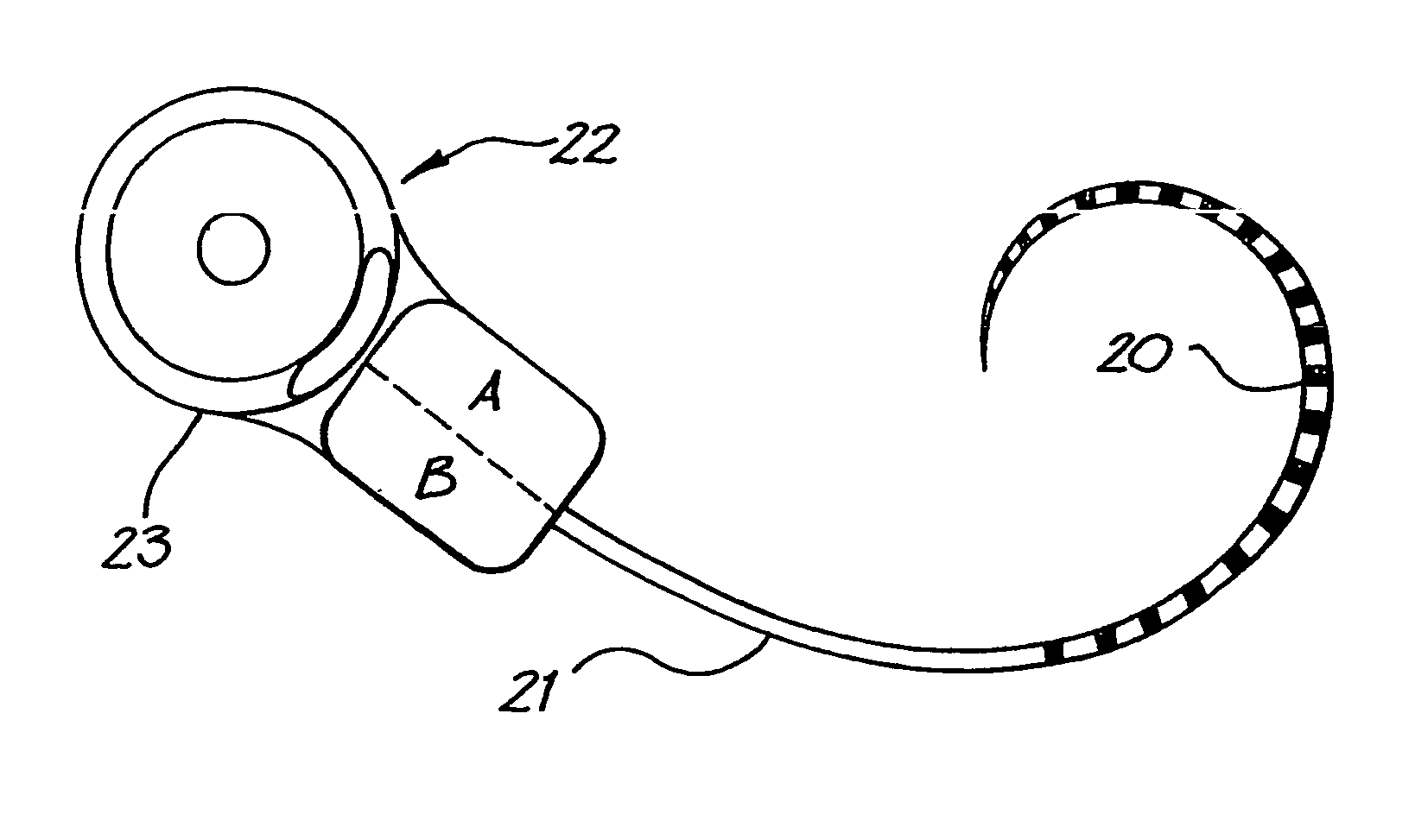 Subthreshold stimulation of a cochlea