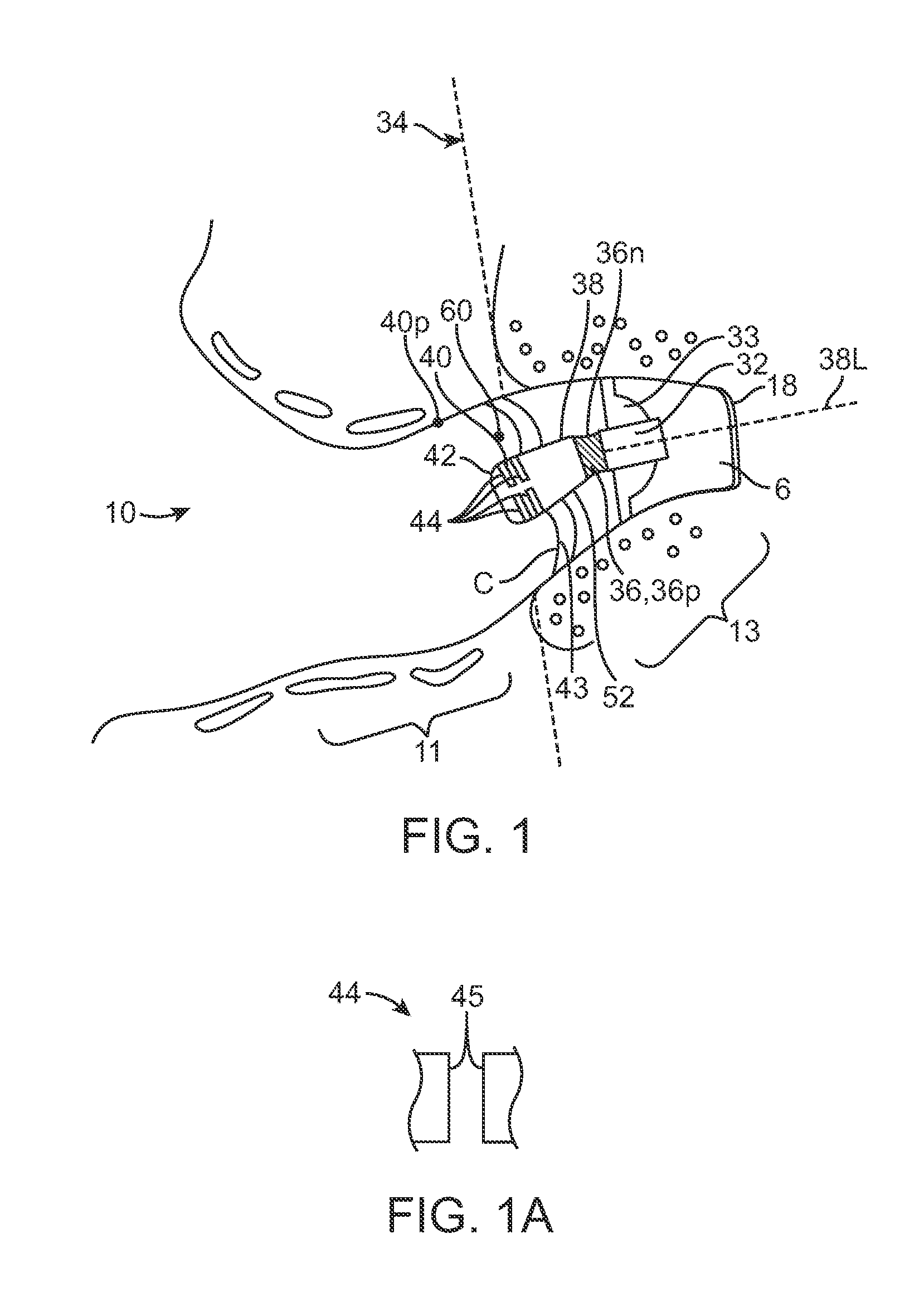 Contamination resistant ports for hearing devices