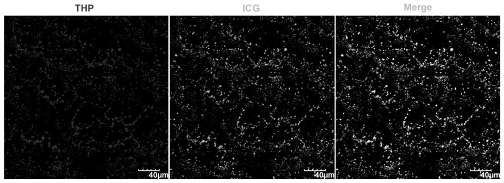 Human-derived polypeptides and applications thereof for constructing tumor pH-responsive microrobots