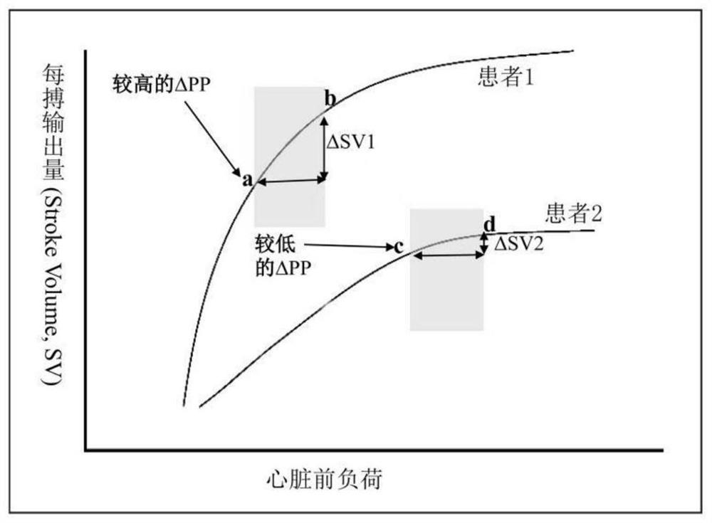 Special assessment method for pulse pressure variability corrected by respiratory mechanics