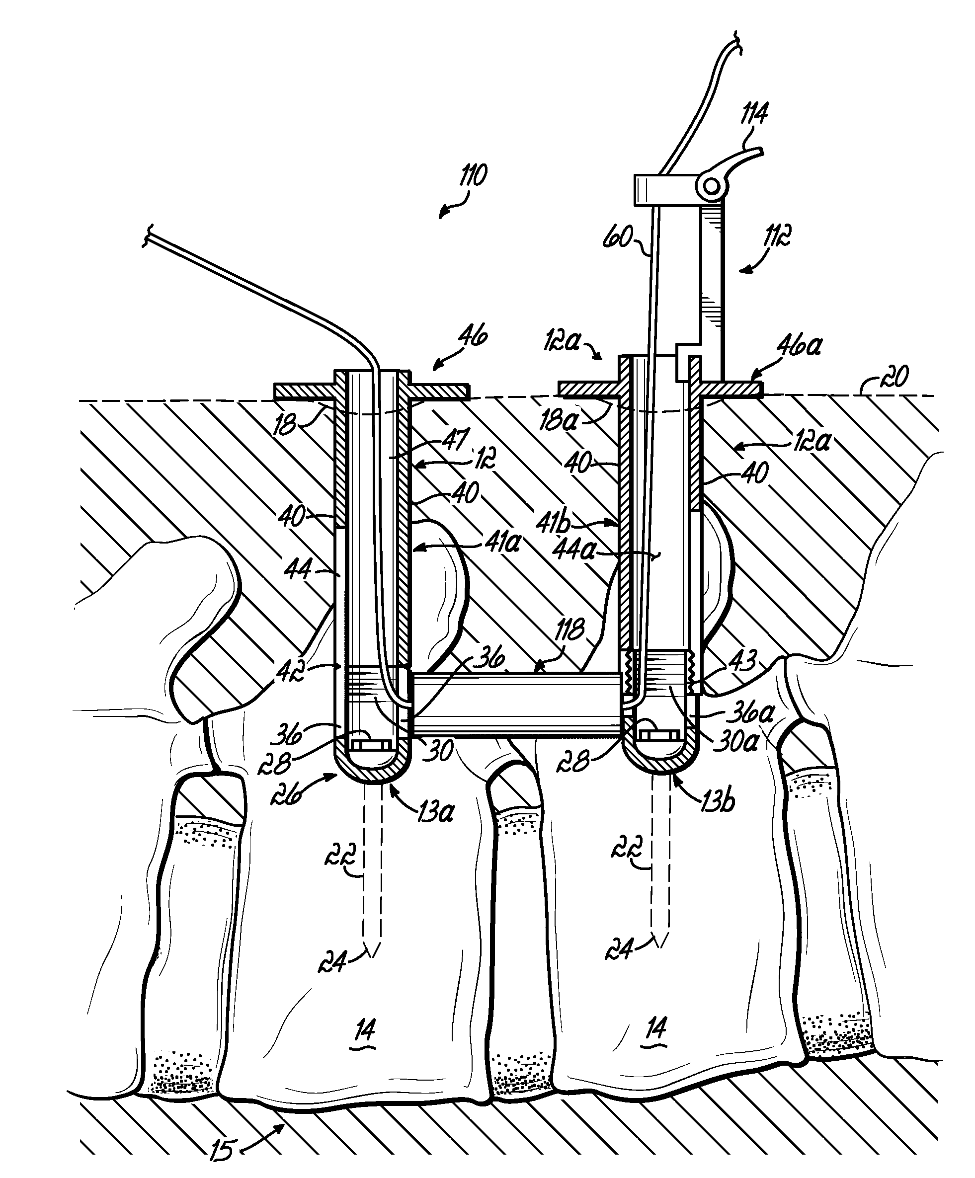 Instrumentation and associated techniques for minimally invasive spinal construct installation