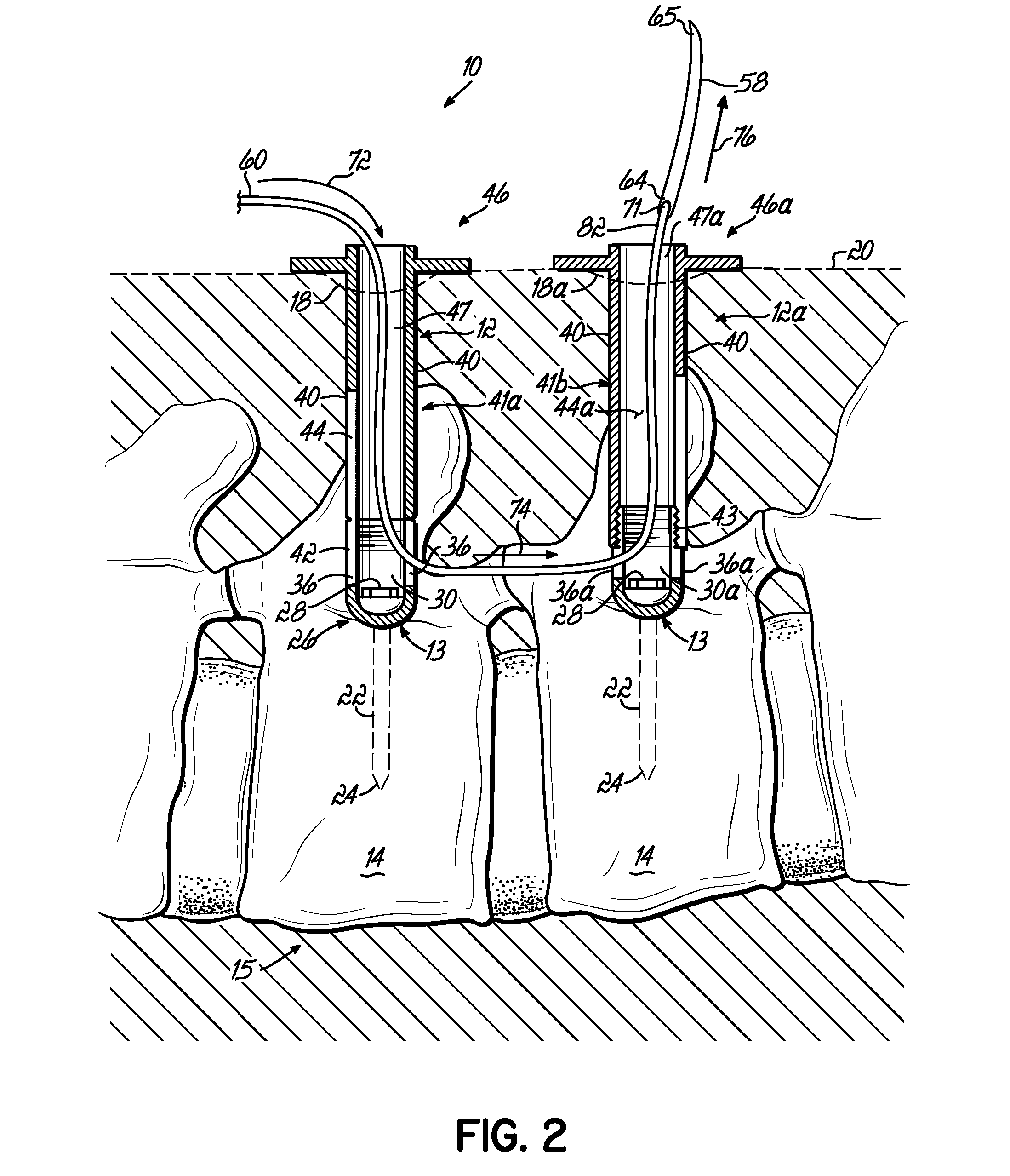 Instrumentation and associated techniques for minimally invasive spinal construct installation