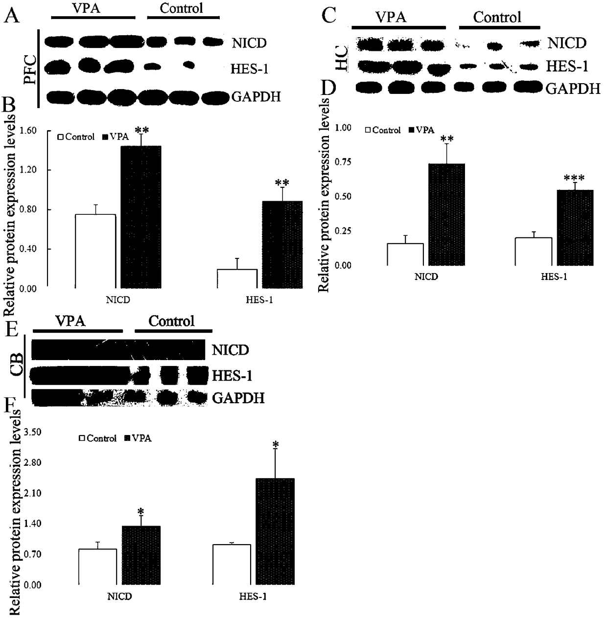 Application of Notch signaling pathway inhibitor in preparation of drugs treating autism