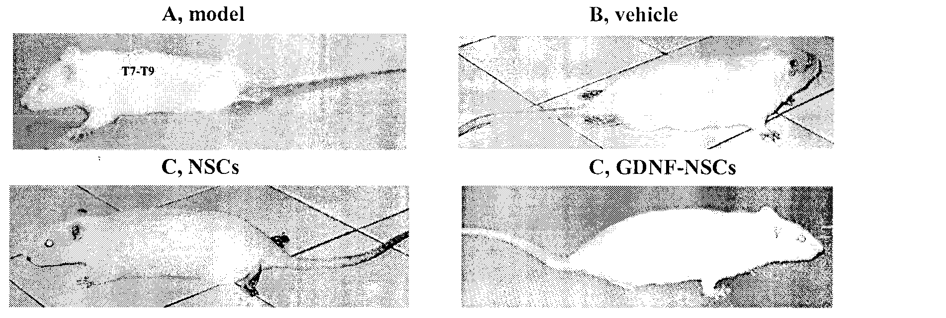 Treatment of spinal cord injury by transplanting stem cells modified by neurotrophic factor gene