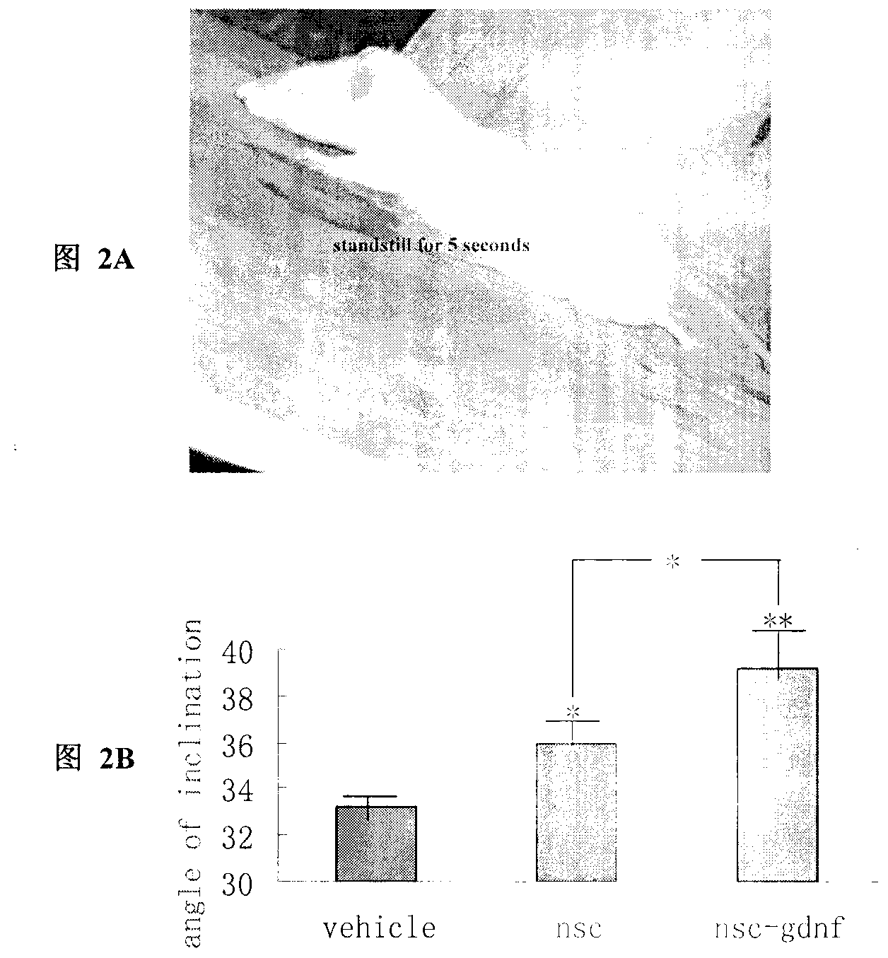Treatment of spinal cord injury by transplanting stem cells modified by neurotrophic factor gene