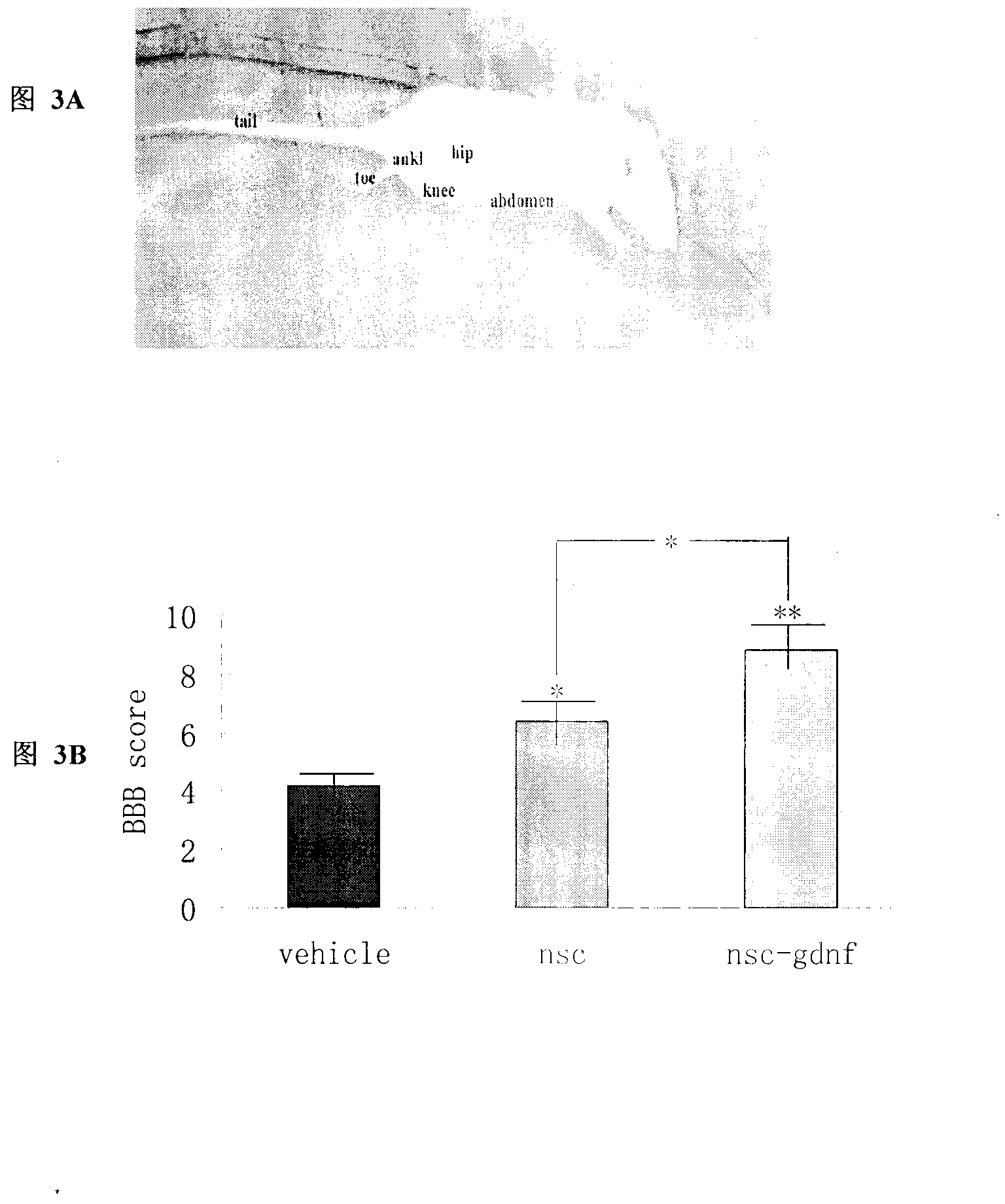 Treatment of spinal cord injury by transplanting stem cells modified by neurotrophic factor gene