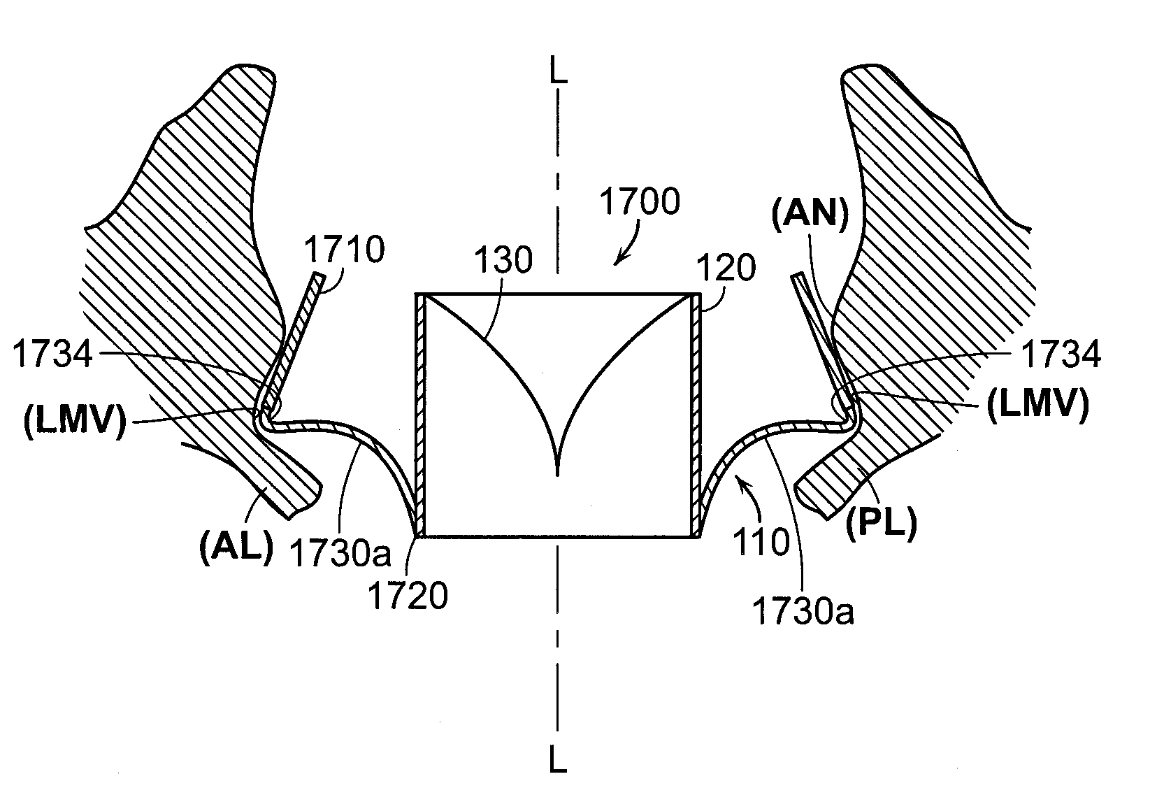 Prosthetic heart valve devices, prosthetic mitral valves and associated systems and methods