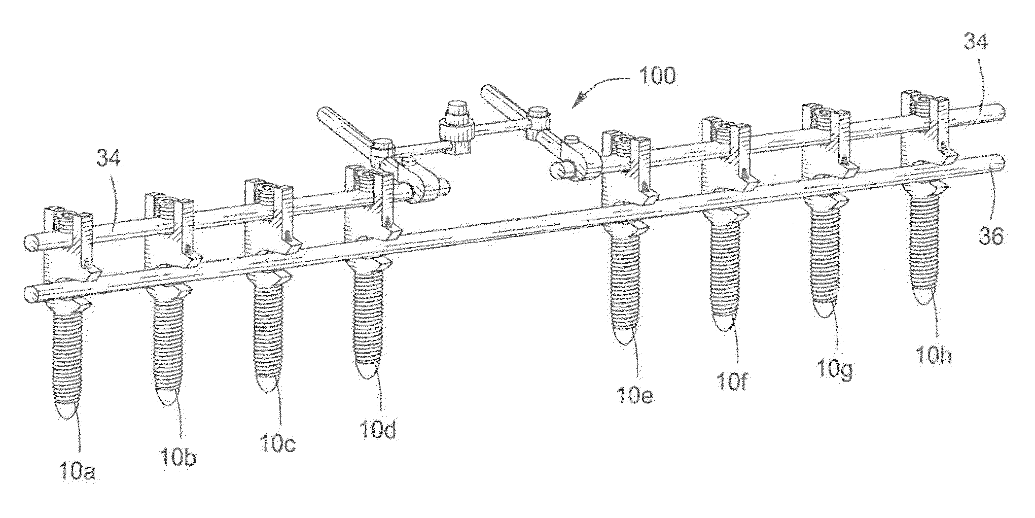 Pedicle Screw