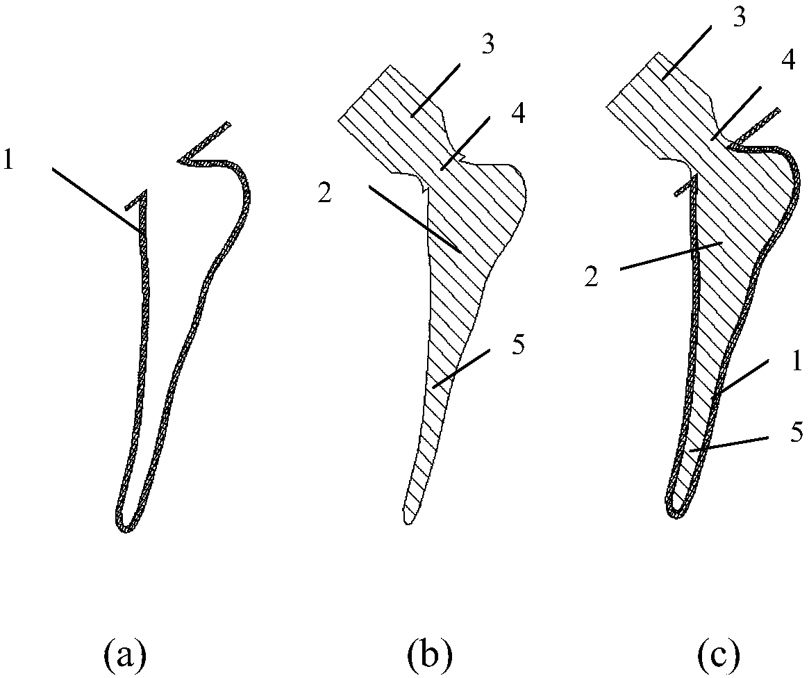 Personalized femoral stem prosthesis easy to remove and renovate and manufacturing method thereof