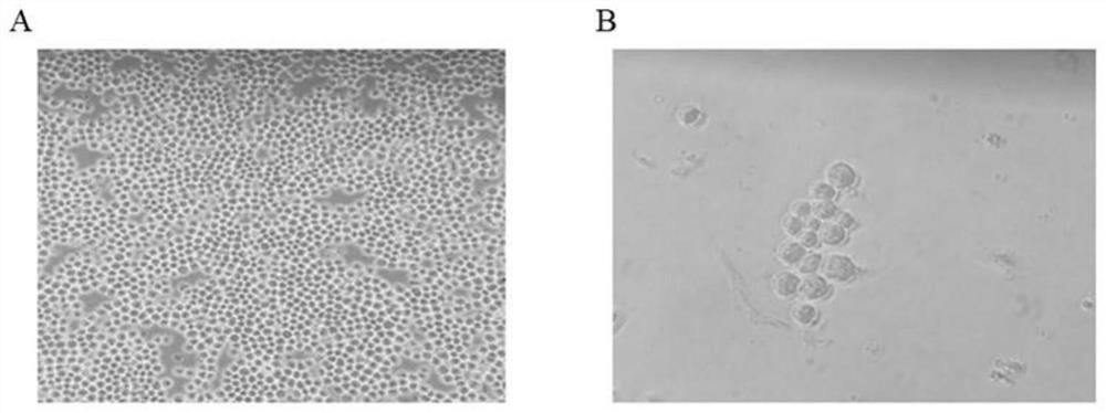 Anti-staphylococcus aureus monoclonal antibody, application and immunomagnetic beads containing same