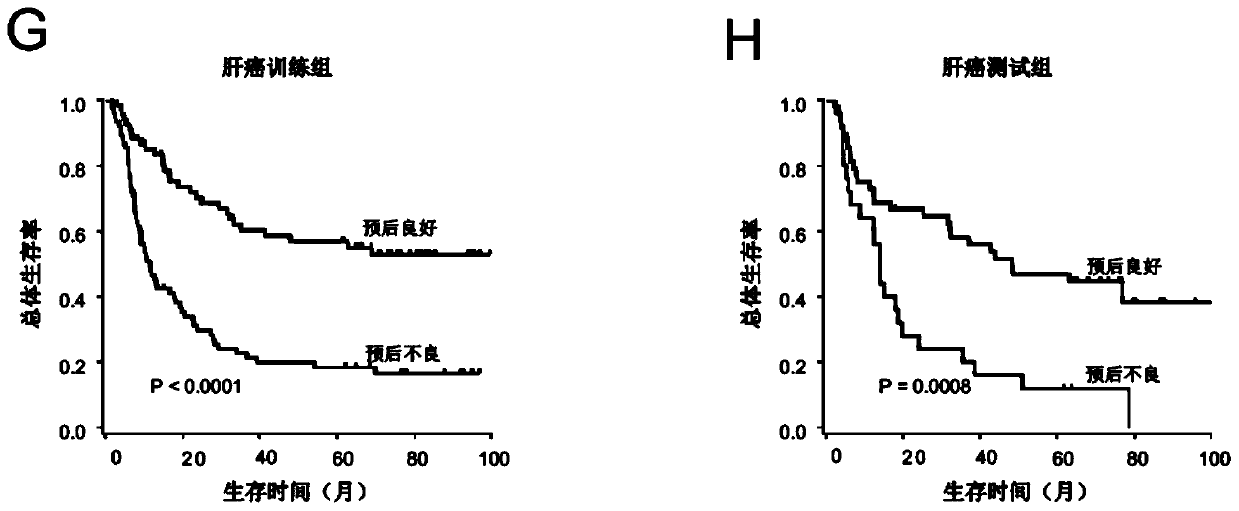 A system for predicting the prognosis of patients with liver cancer