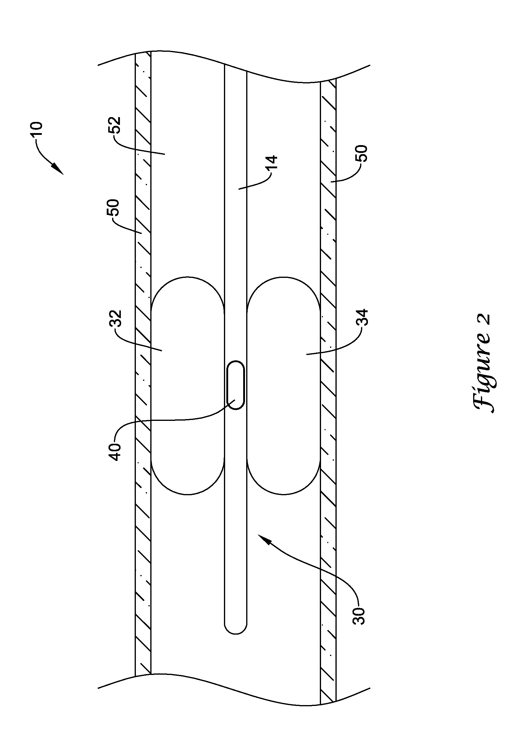 Device and methods for renal nerve modulation