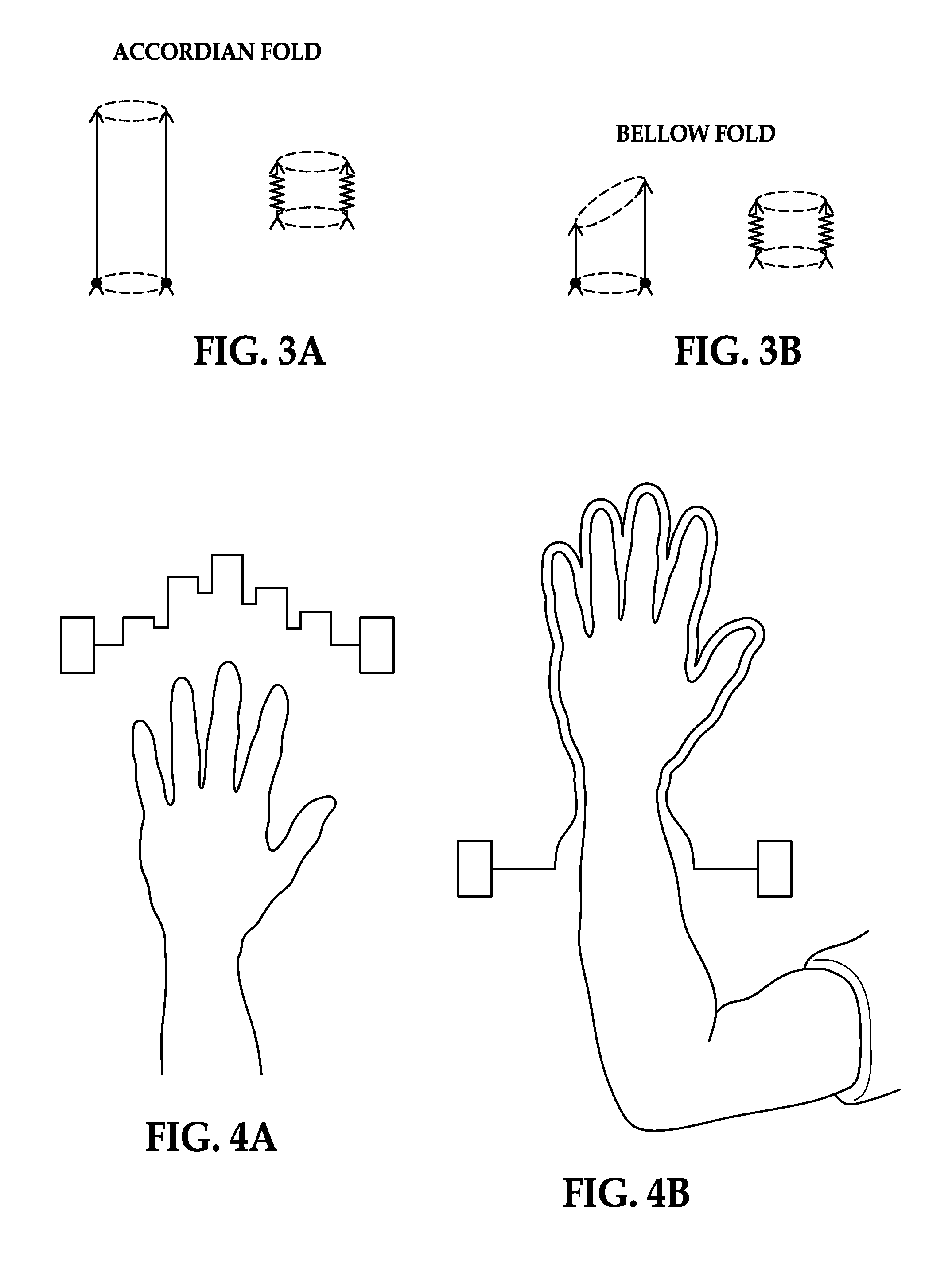 Surgical glove appliance device