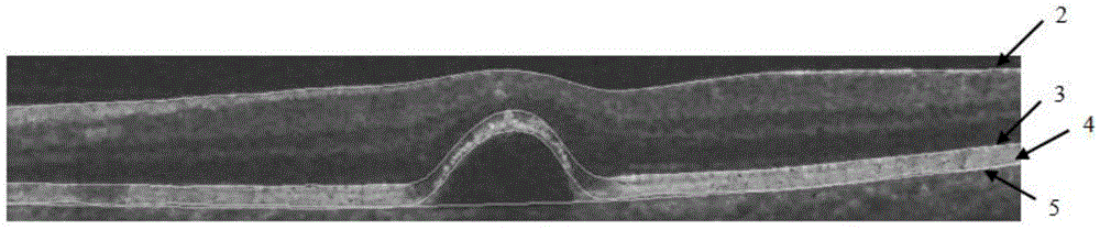 Automatic segmentation method for retina serous pigment epithelial layer detachment