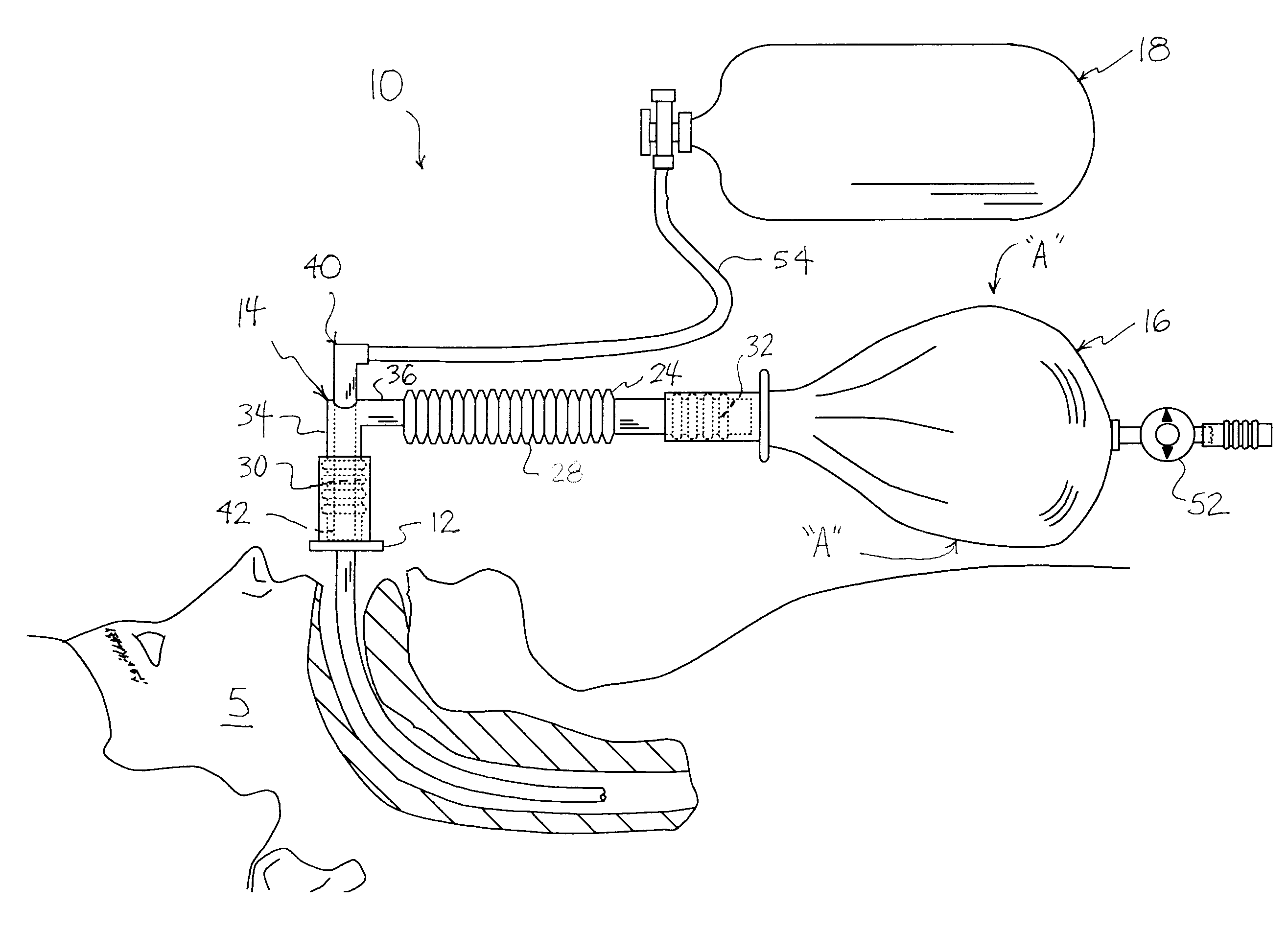 Breathing circuit