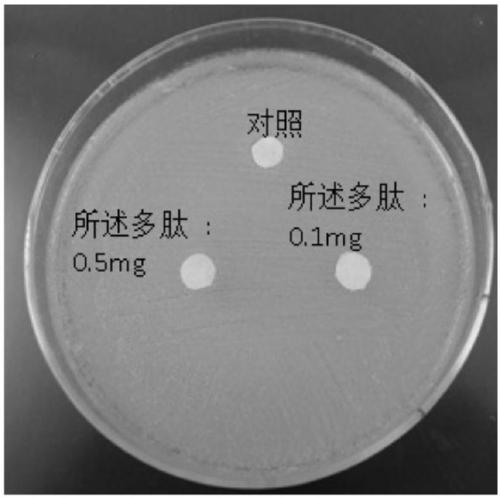 Application of polypeptide in preparing preparations for preventing and treating human papilloma virus infection