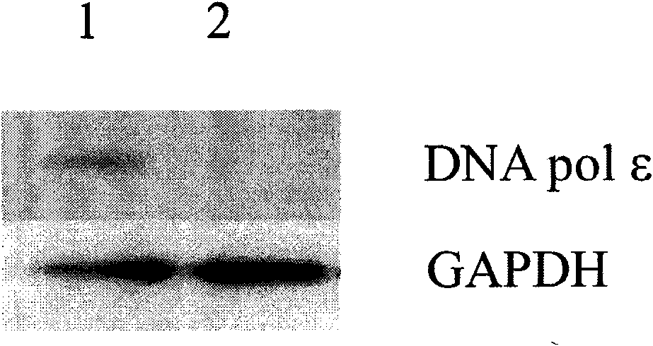 Carcinoembryonic antigen positive cell targeted gene expression element CPE and application thereof