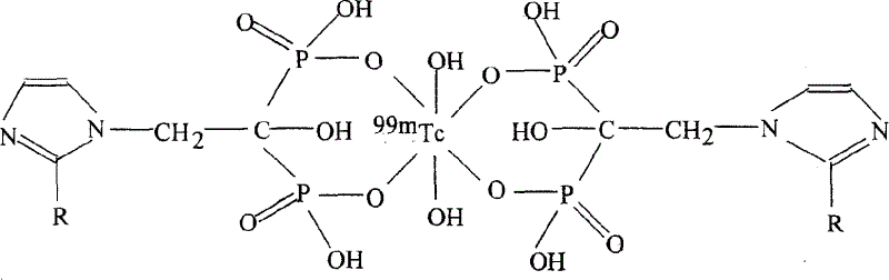 Diphospho-acid complex of radiative technetium-99m marked oxazole phosphinic acid