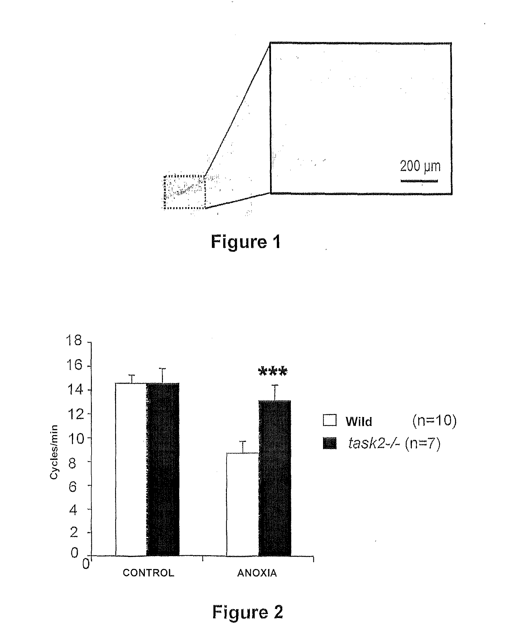 Method of screening for compounds that can be used for the treatment of respiratory conditions