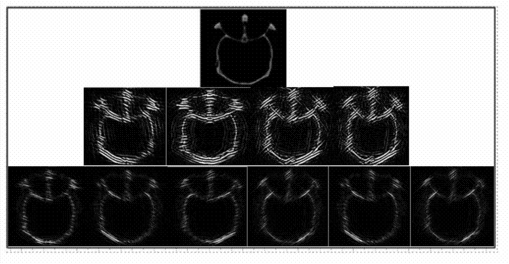 Multimode medical image fusion method based on translation constant shear wave transformation