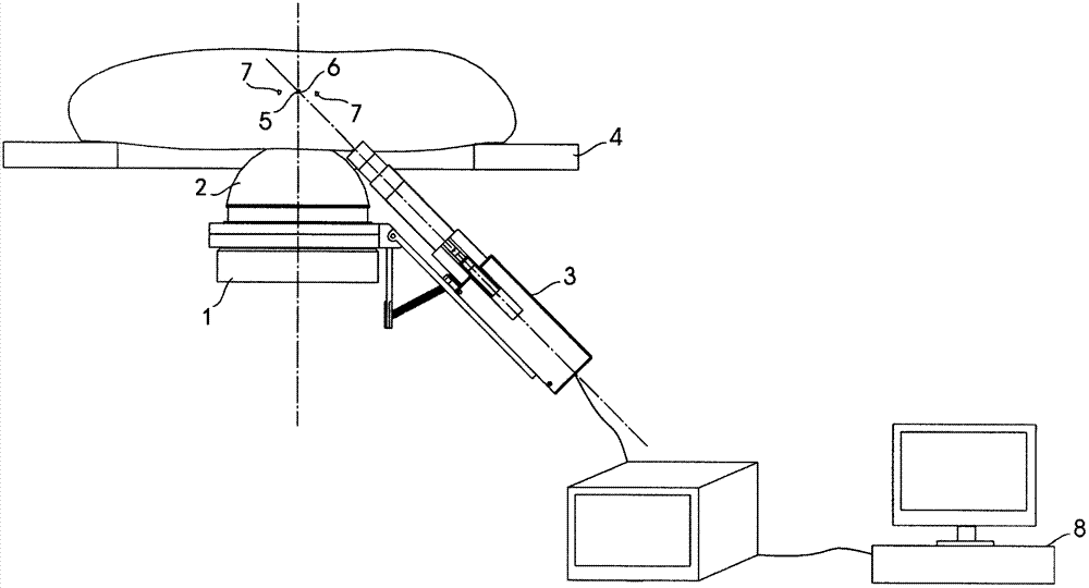 Method of inspecting target stone with B ultrasound of extracorporeal shock wave lithotripter