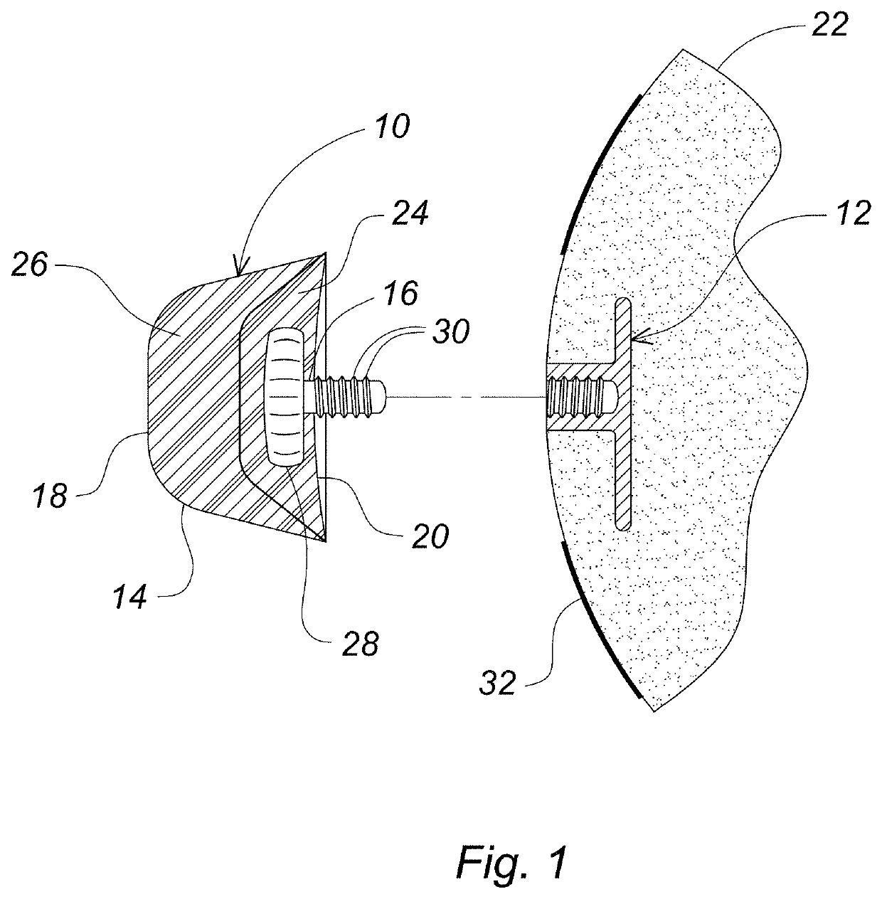 Nipple implant system