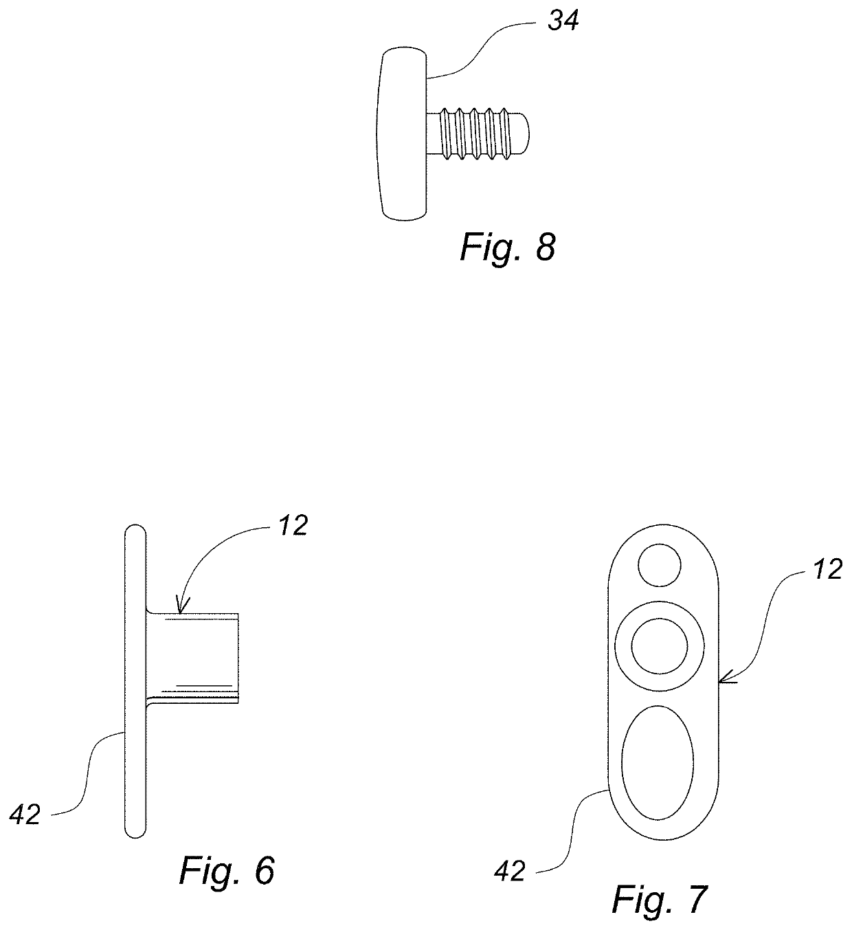 Nipple implant system