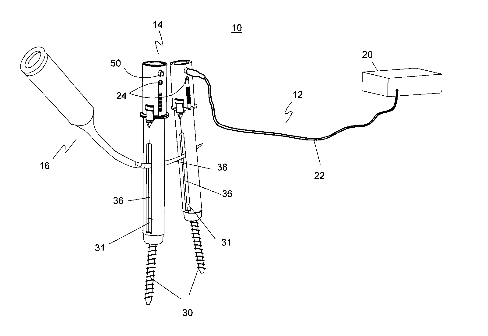 Electromagnetically guided spinal rod system and related methods