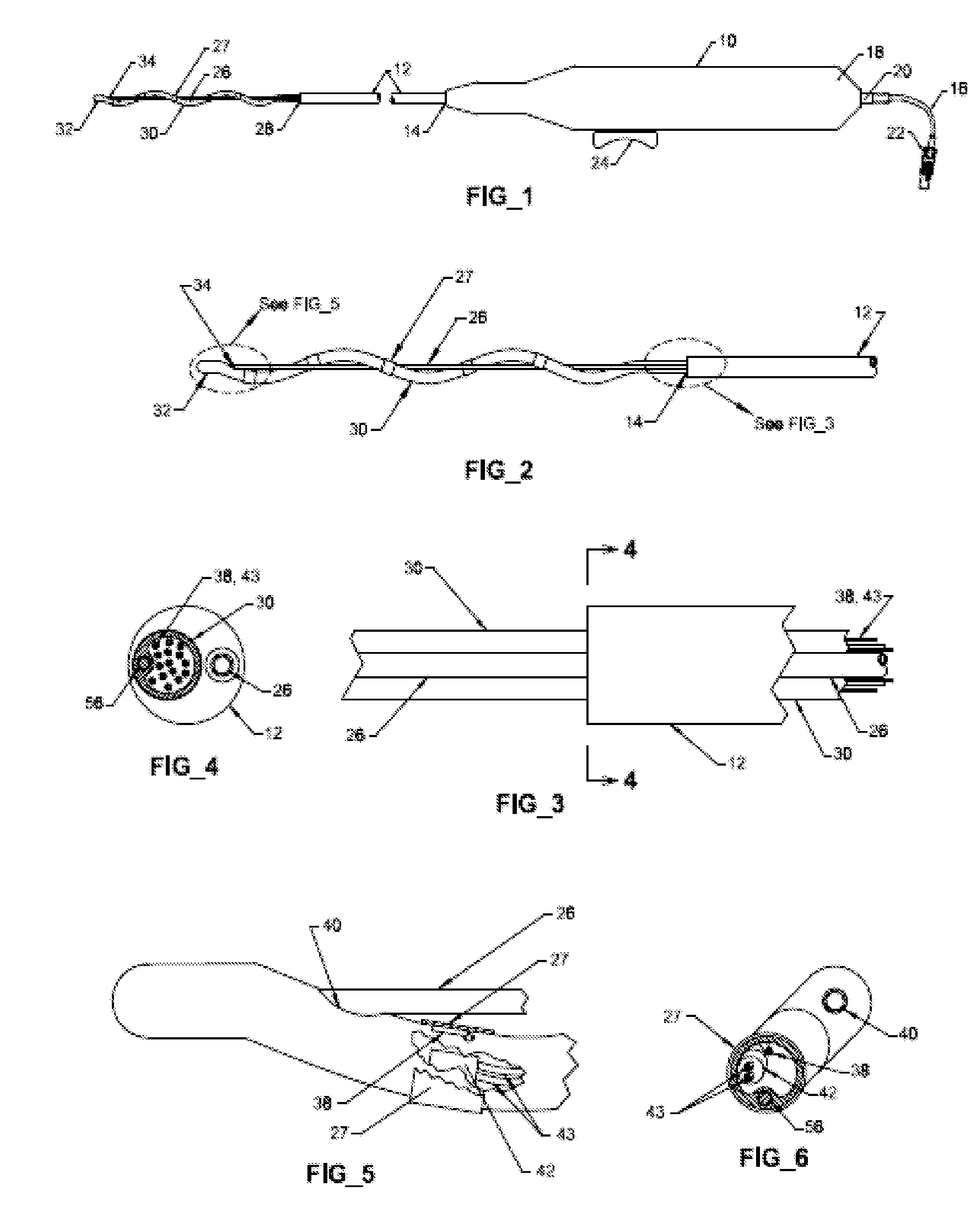 Helical DeNervation Ablation Catheter Apparatus