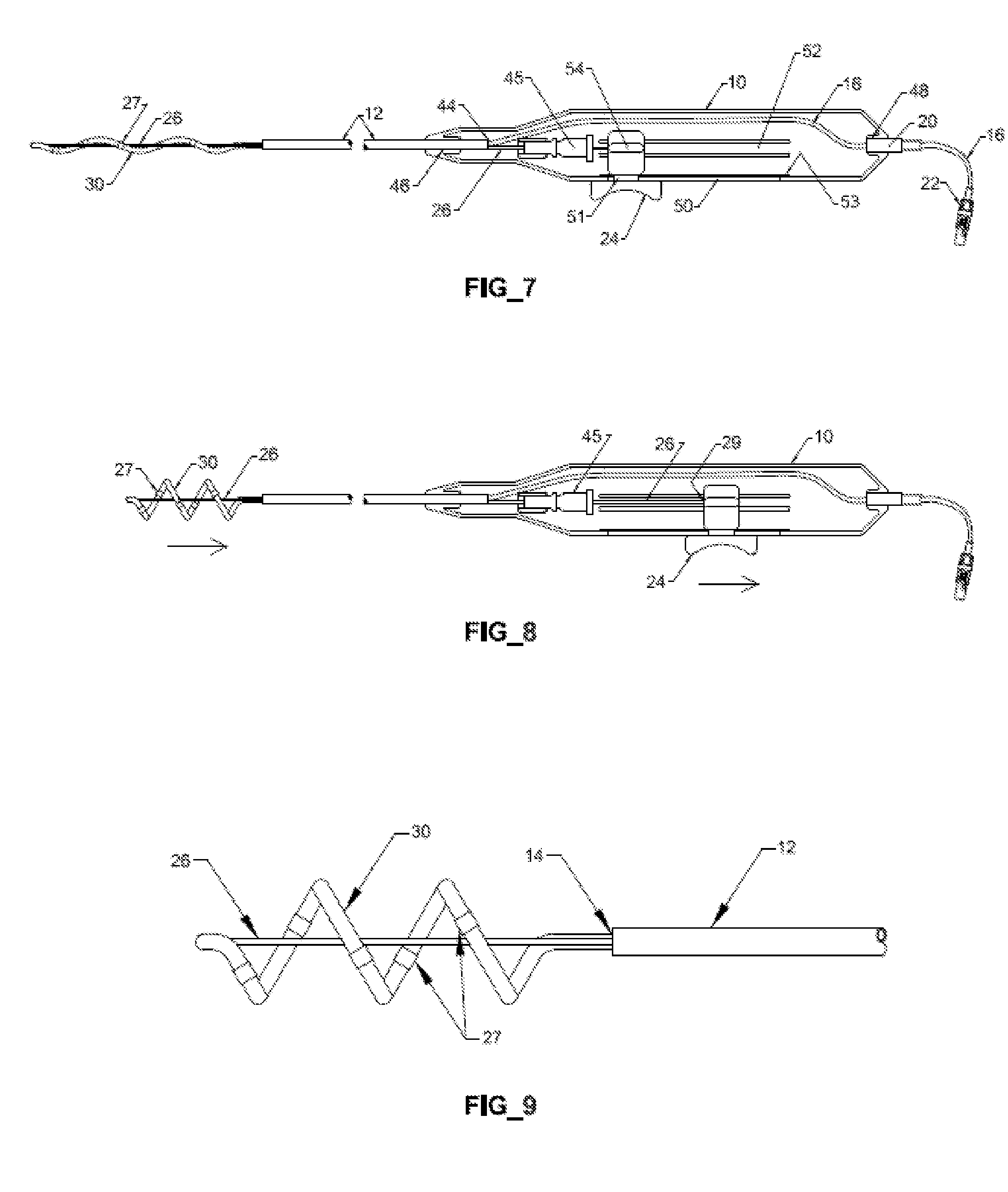 Helical DeNervation Ablation Catheter Apparatus