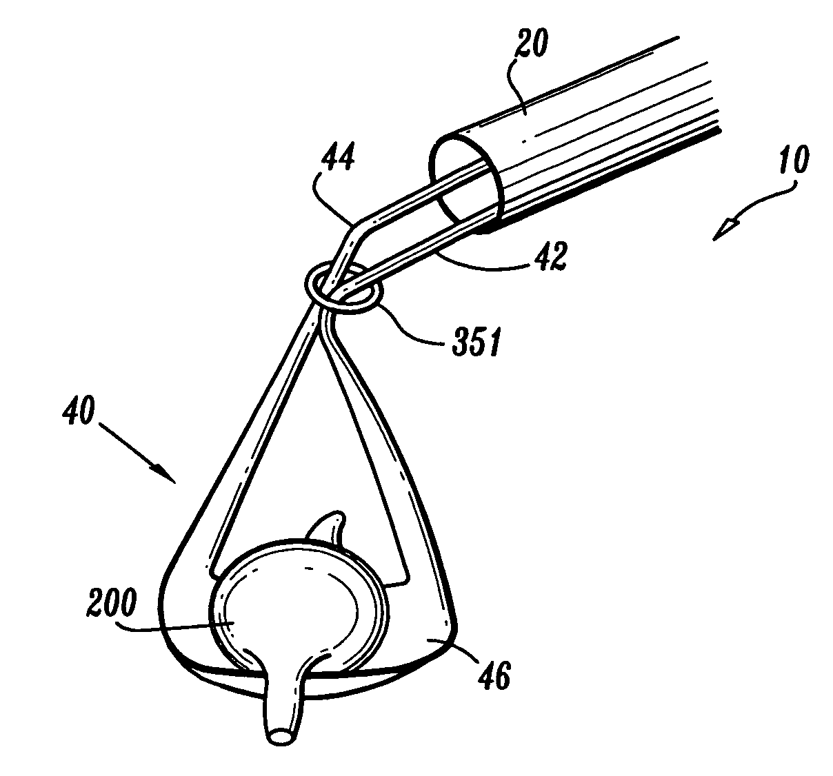 Organ retractor and method of using the same