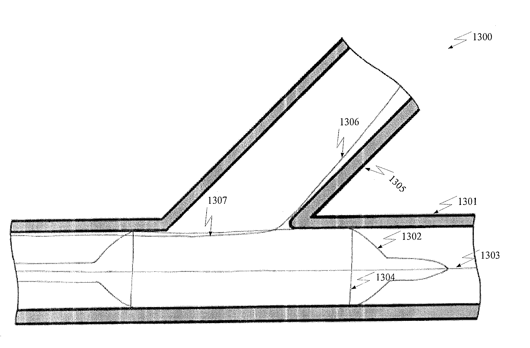 Bifurcated Stent and Delivery System