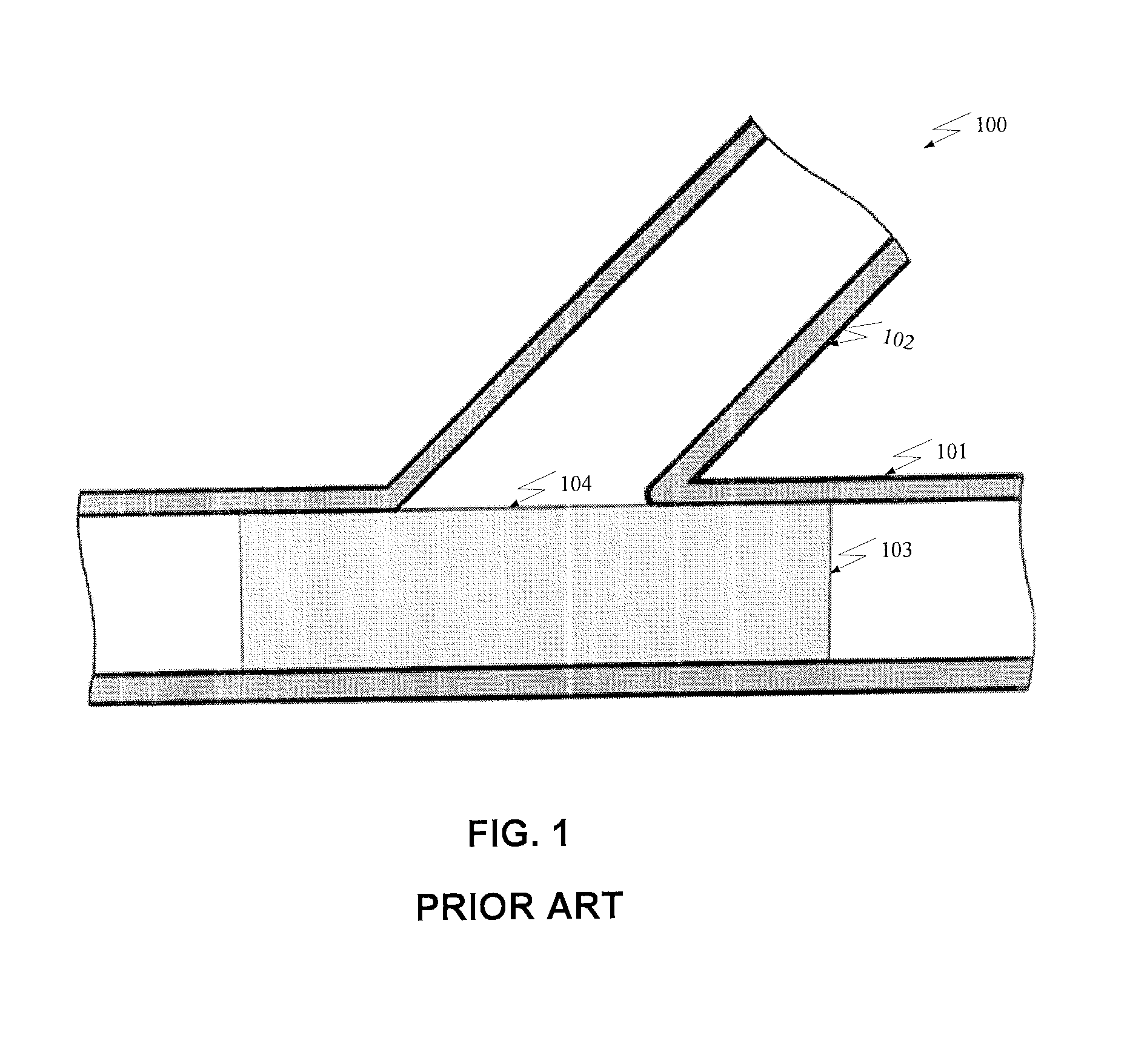 Bifurcated Stent and Delivery System