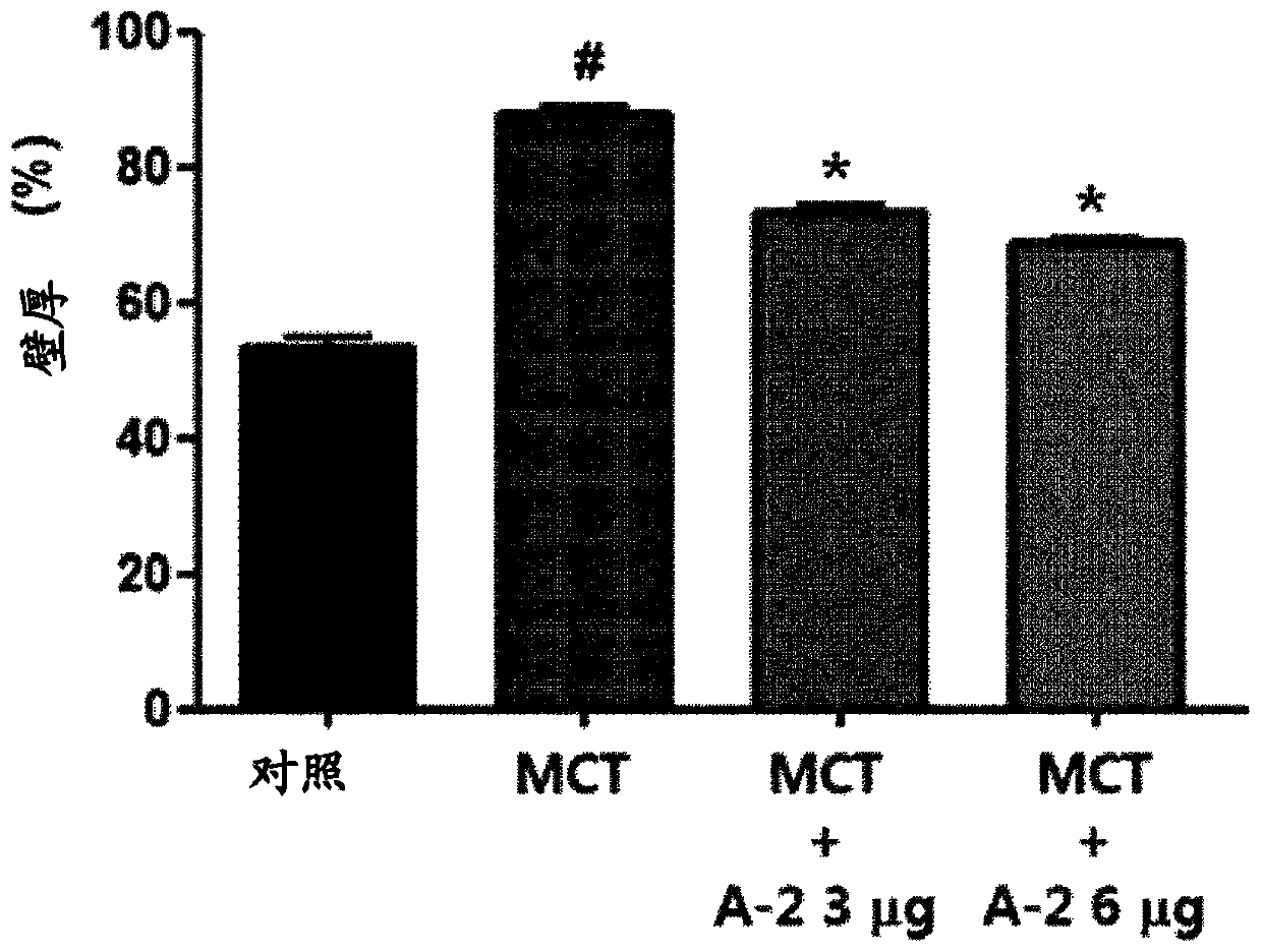 Epidithiodioxopiperazine compound or derivative thereof, or pharmaceutical composition for preventing or treating pulmonary hypertension, containing pharmaceutically acceptable salts thereof