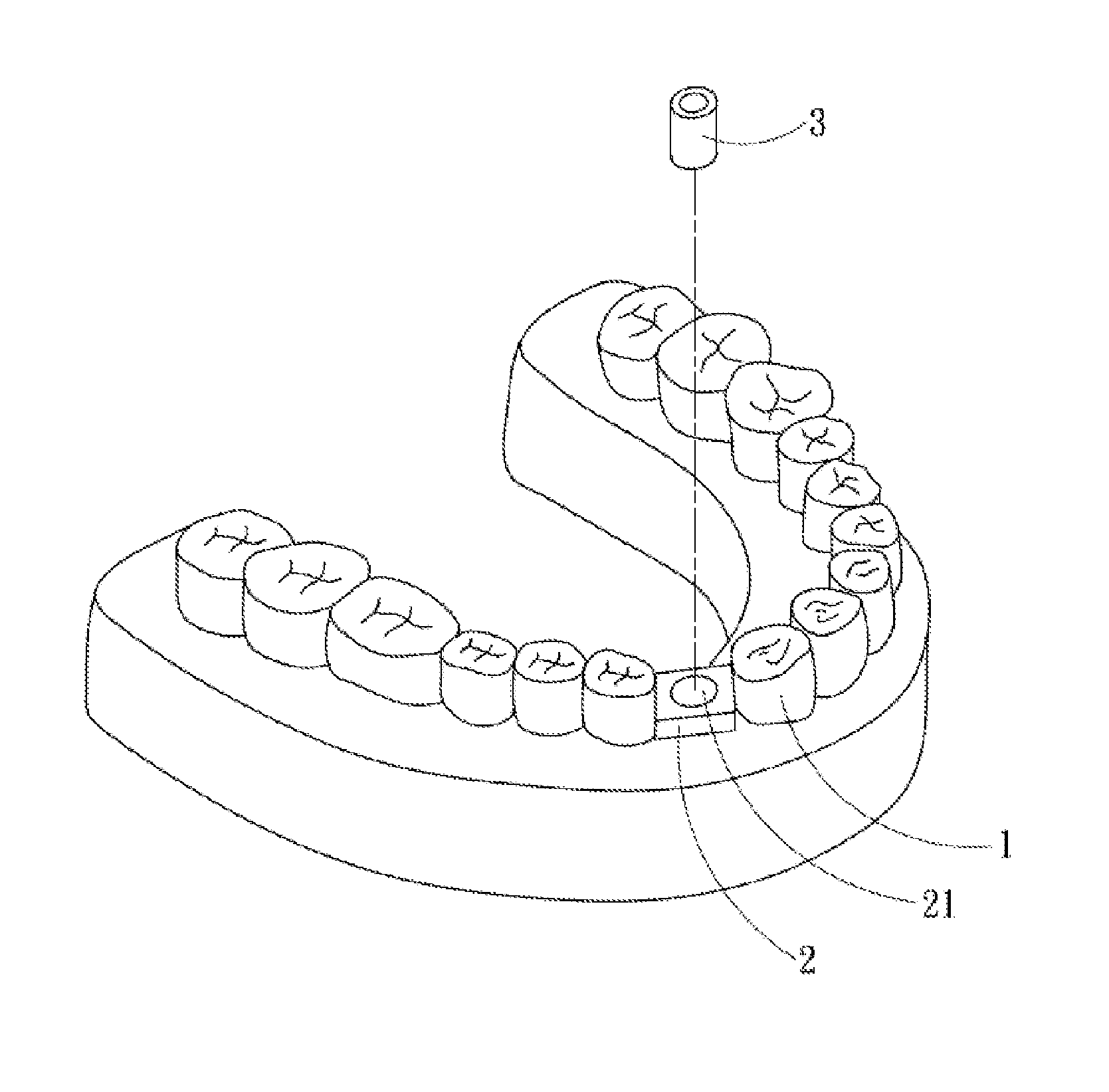 Dental positioning stent, and manufacturing method, using method and components for the same