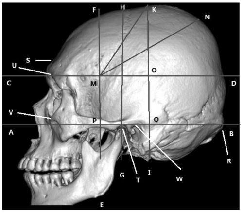 Skull detection method and device