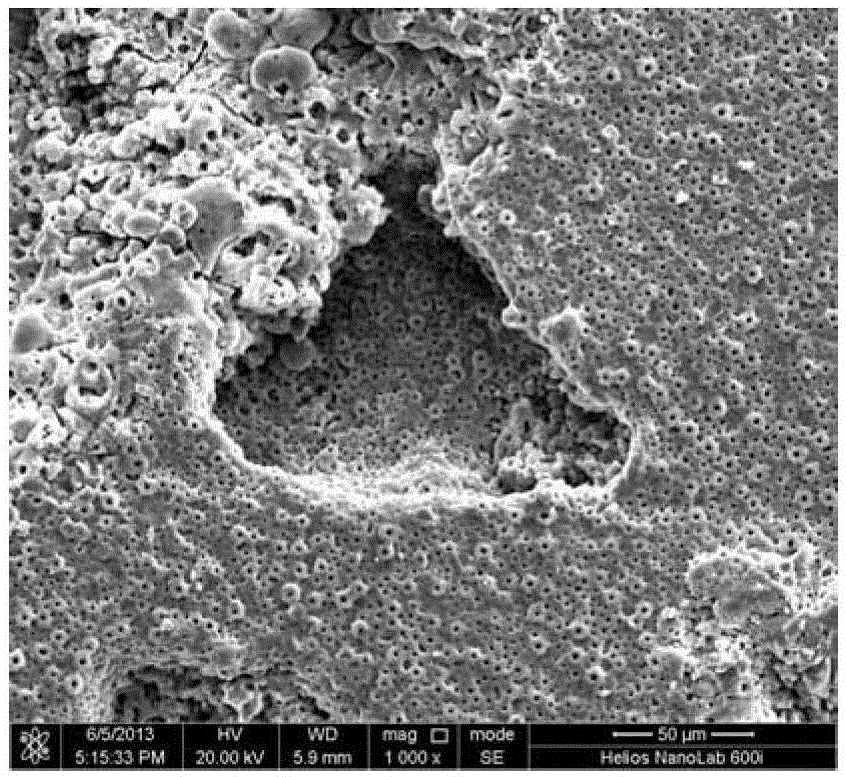 Method for preparing bioactive micro-arc oxidation ceramic coating with macroscopic/microscopic dual-stage pore structure by two-step method on medical titanium surface
