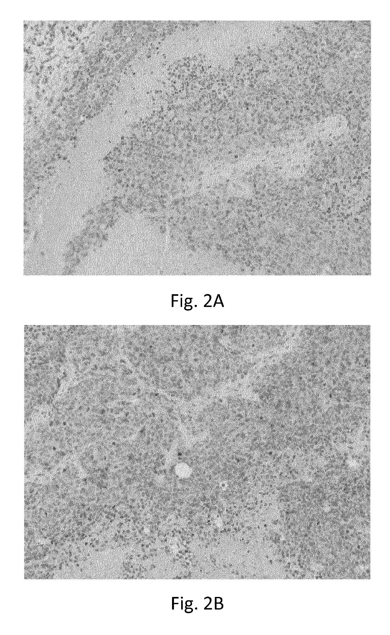 Combination therapy comprising an inflammatory immunocytokine and a chimeric antigen receptor (CAR)-t cell