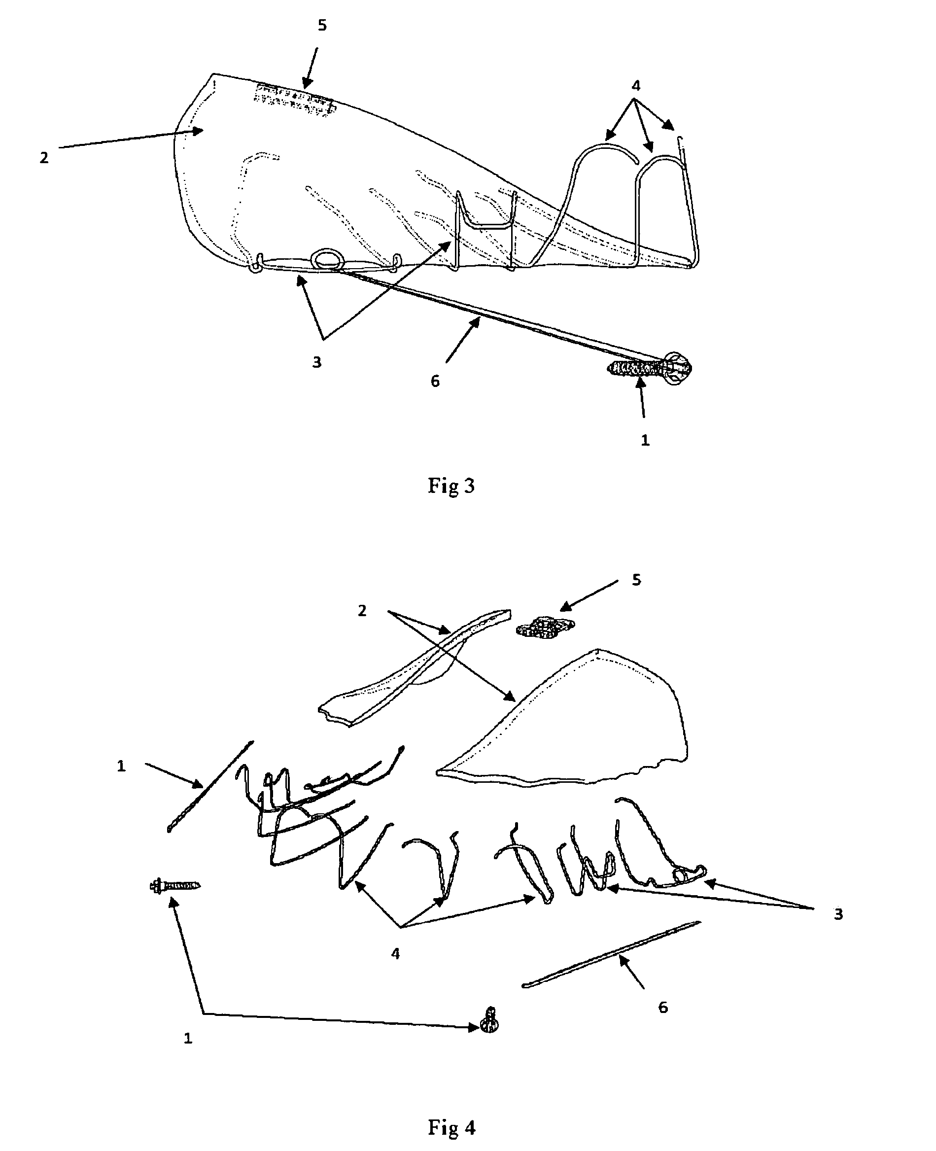 Method and system for treatment of maxillary deficiency using miniscrews