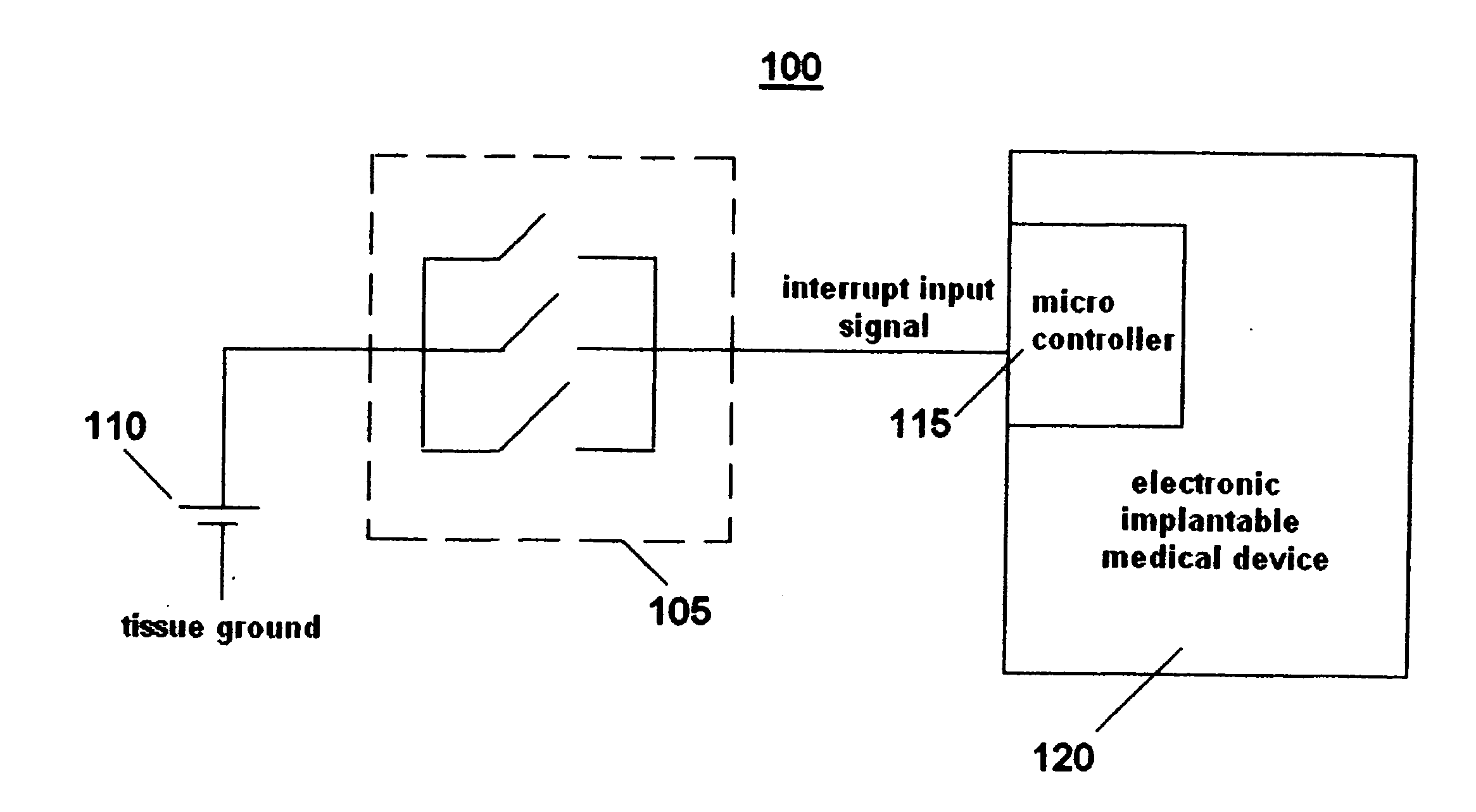 System and method for controlling an implantable medical device subject to magnetic field or radio frequency exposure