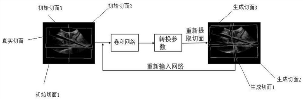 Obtaining method of pelvic floor levator ani sections, storage medium and terminal equipment