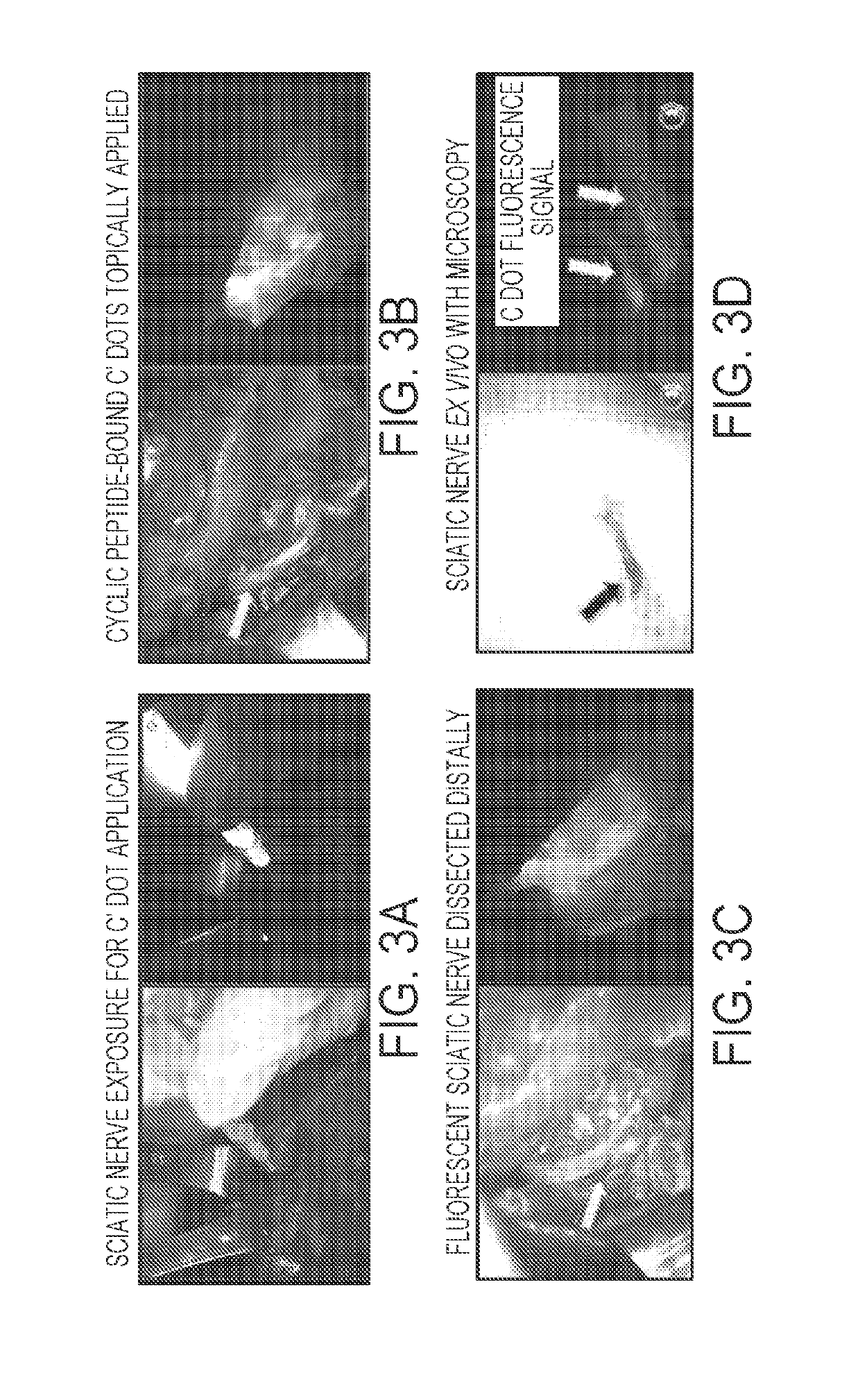 Imaging systems and methods for tissue differentiation, e.g., for intraoperative visualization