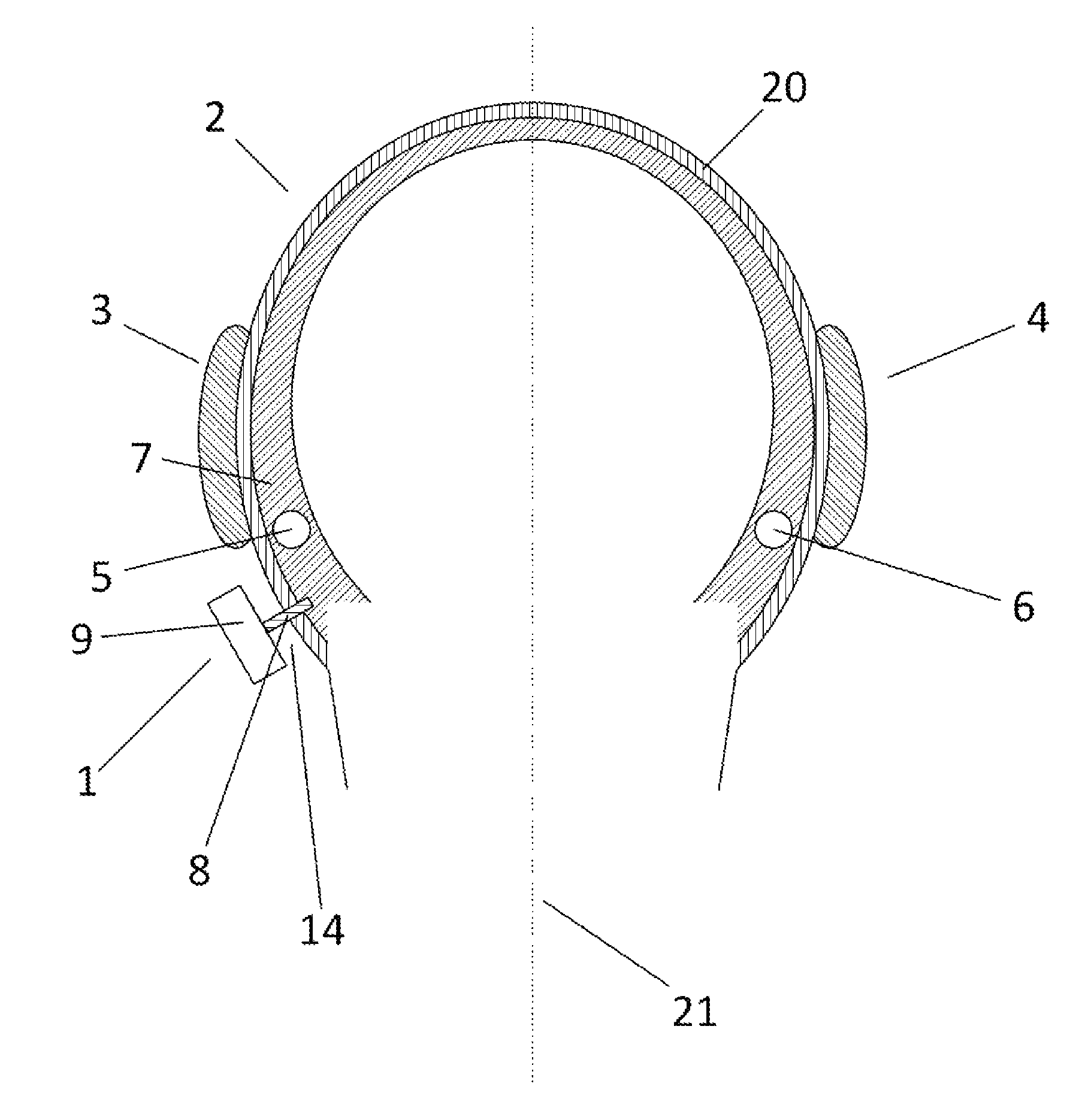 Method of determining a gain setting of a bone-anchored hearing aid