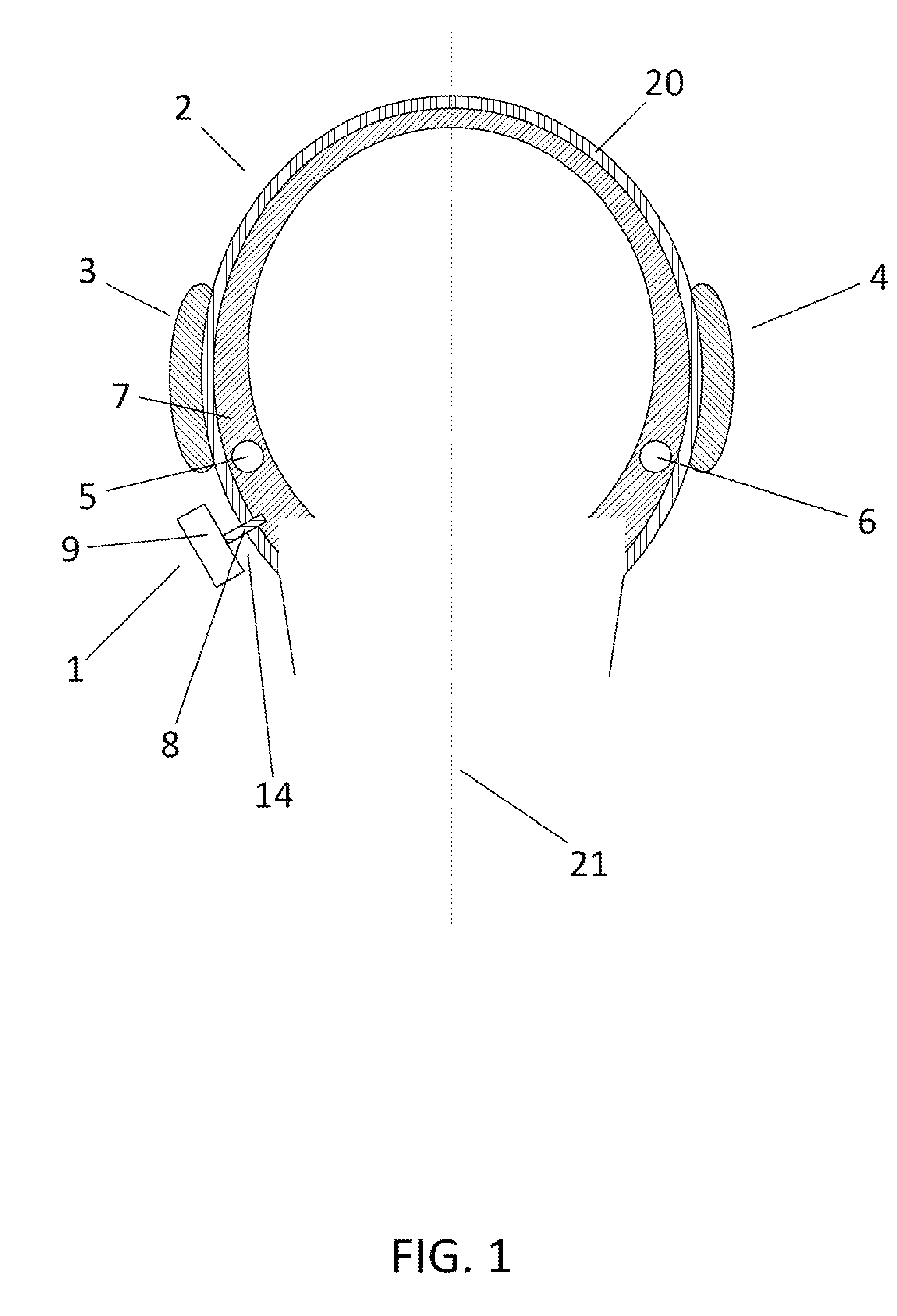 Method of determining a gain setting of a bone-anchored hearing aid