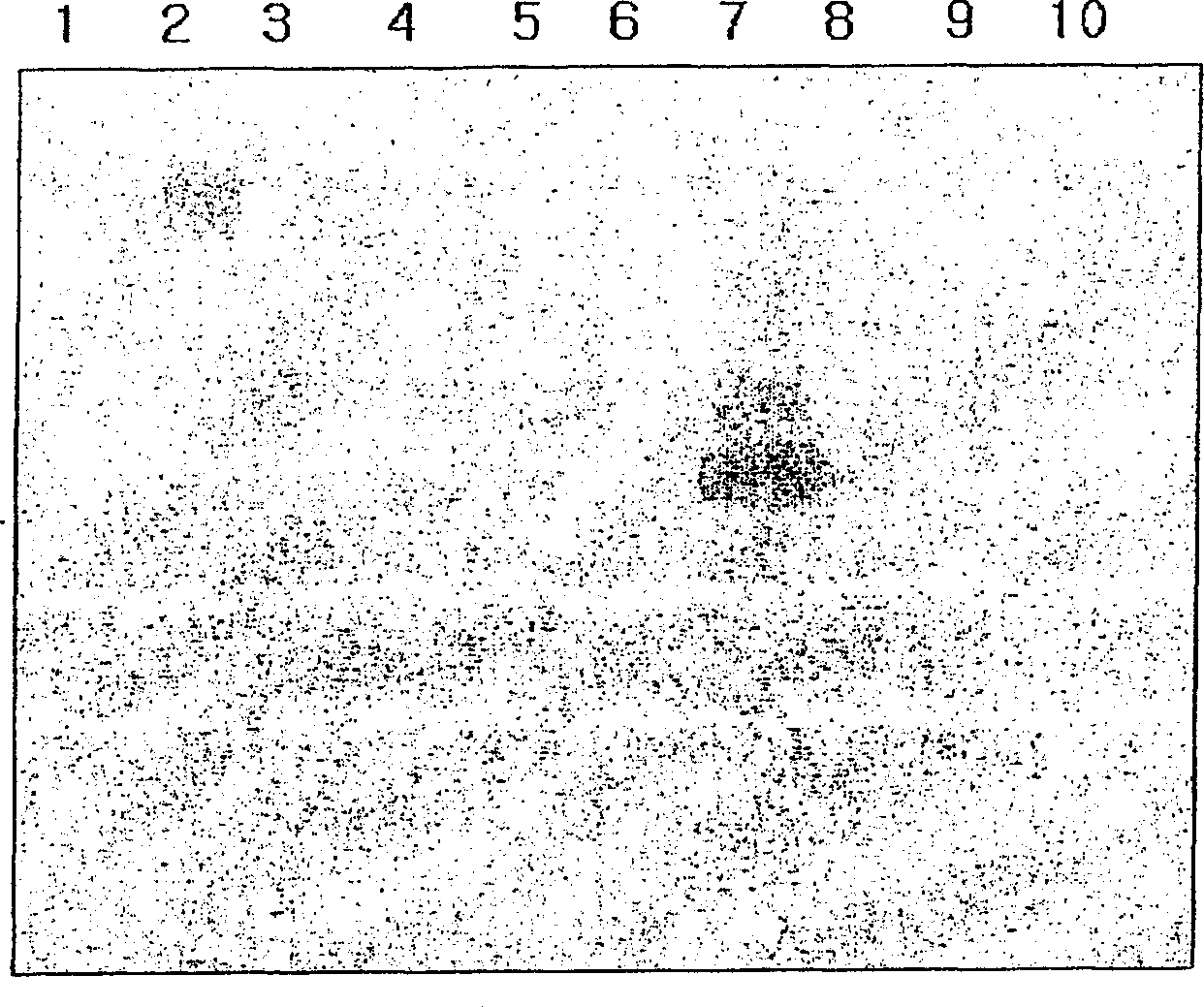 Protein chip for diagnosis allergy and detection method for allergen and antibody