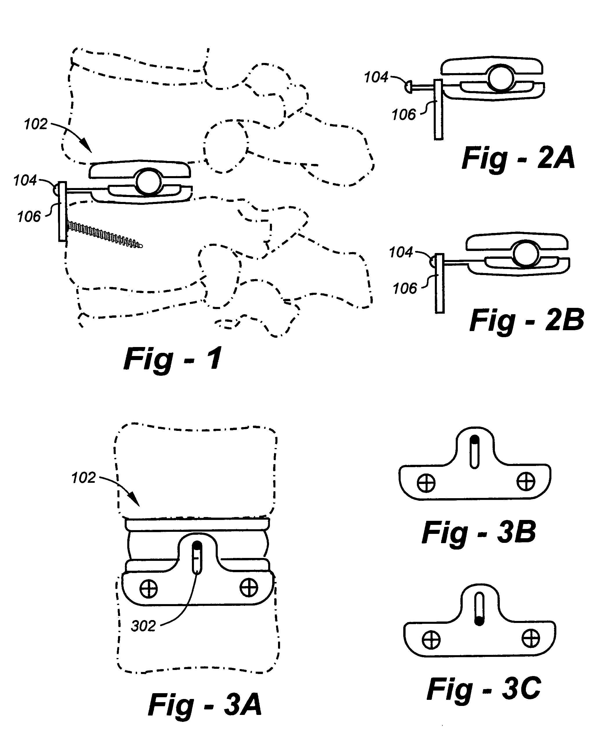 Methods and apparatus for preventing the migration of intradiscal devices