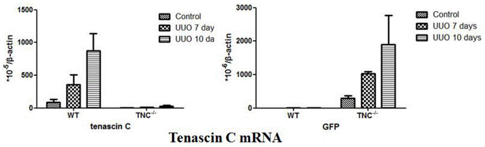 Application of Tenascin-C in preparation of kidney injury diagnosis and treatment preparations