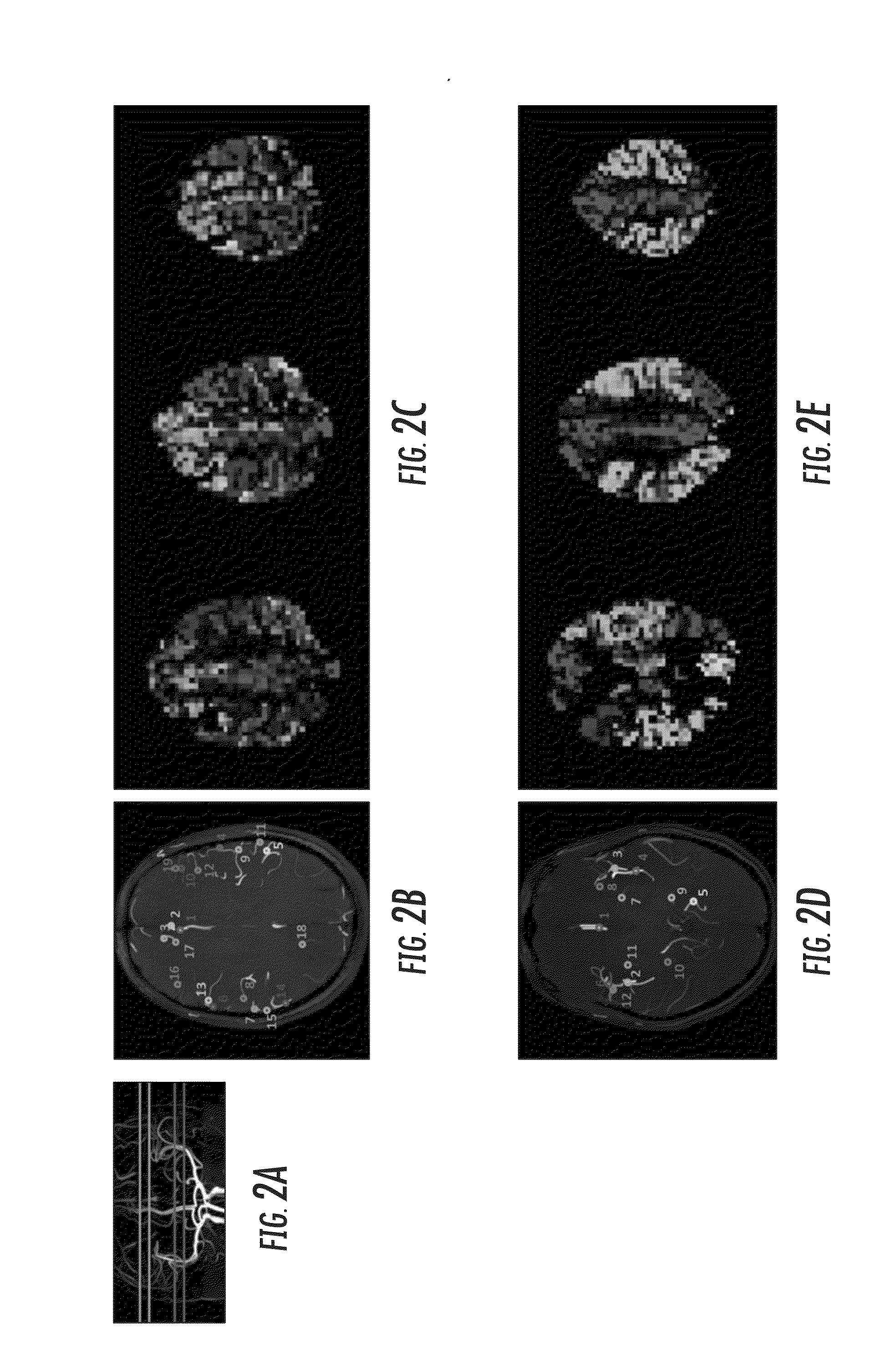 Vascular territory segmentation using mutual clustering information from image space and label space