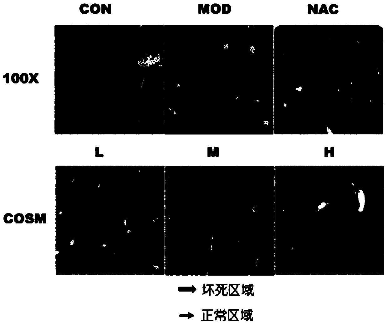 Drug-induced liver injury protecting and treating component and method