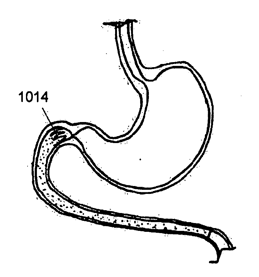 Medical apparatus and method of making the same